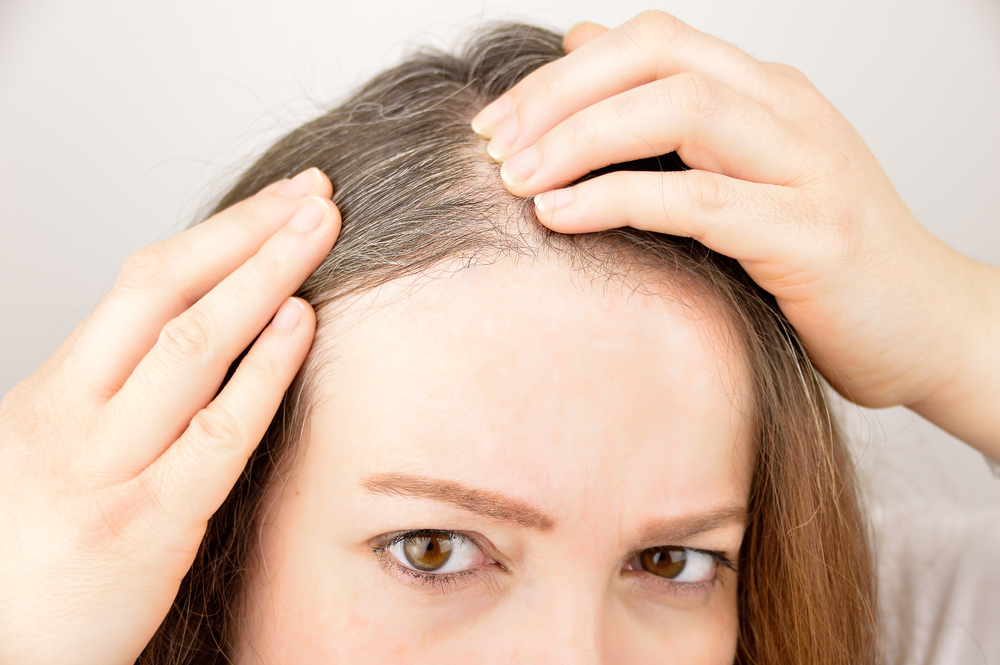 Close-up of a woman concerned about thinning hair, seeking Keralase solutions.