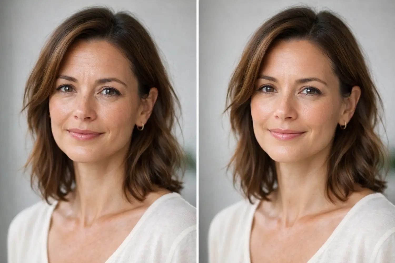 before and after comparison of woman’s face showing smoother skin after Botox treatment
