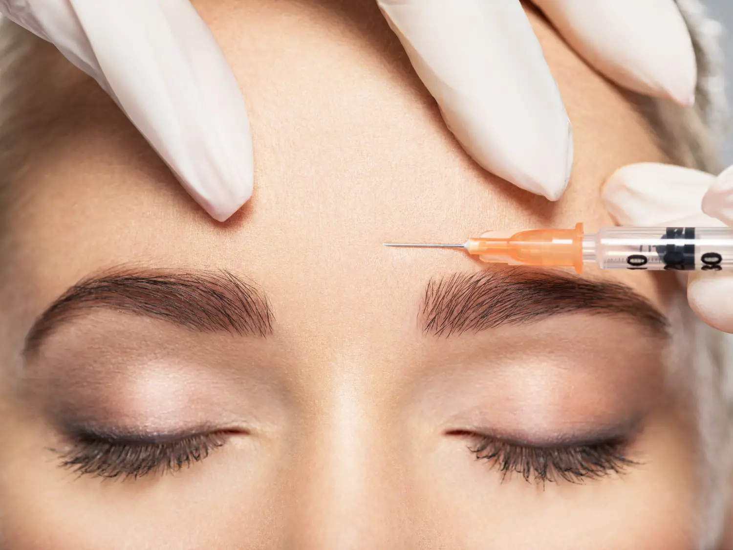 Medical provider preparing to administer a cosmetic injection to a woman’s forehead.