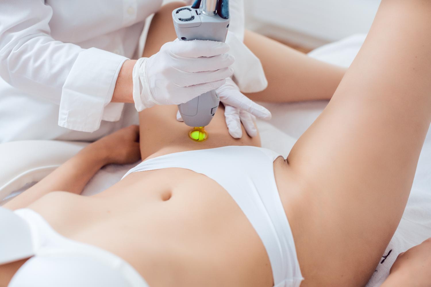 Clinician performing laser hair removal on a woman’s bikini area using a handheld device.