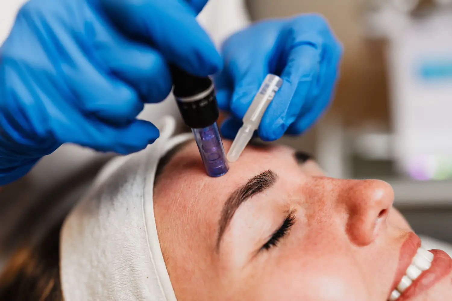Clinician wearing blue gloves performing microneedling treatment on a woman’s forehead.