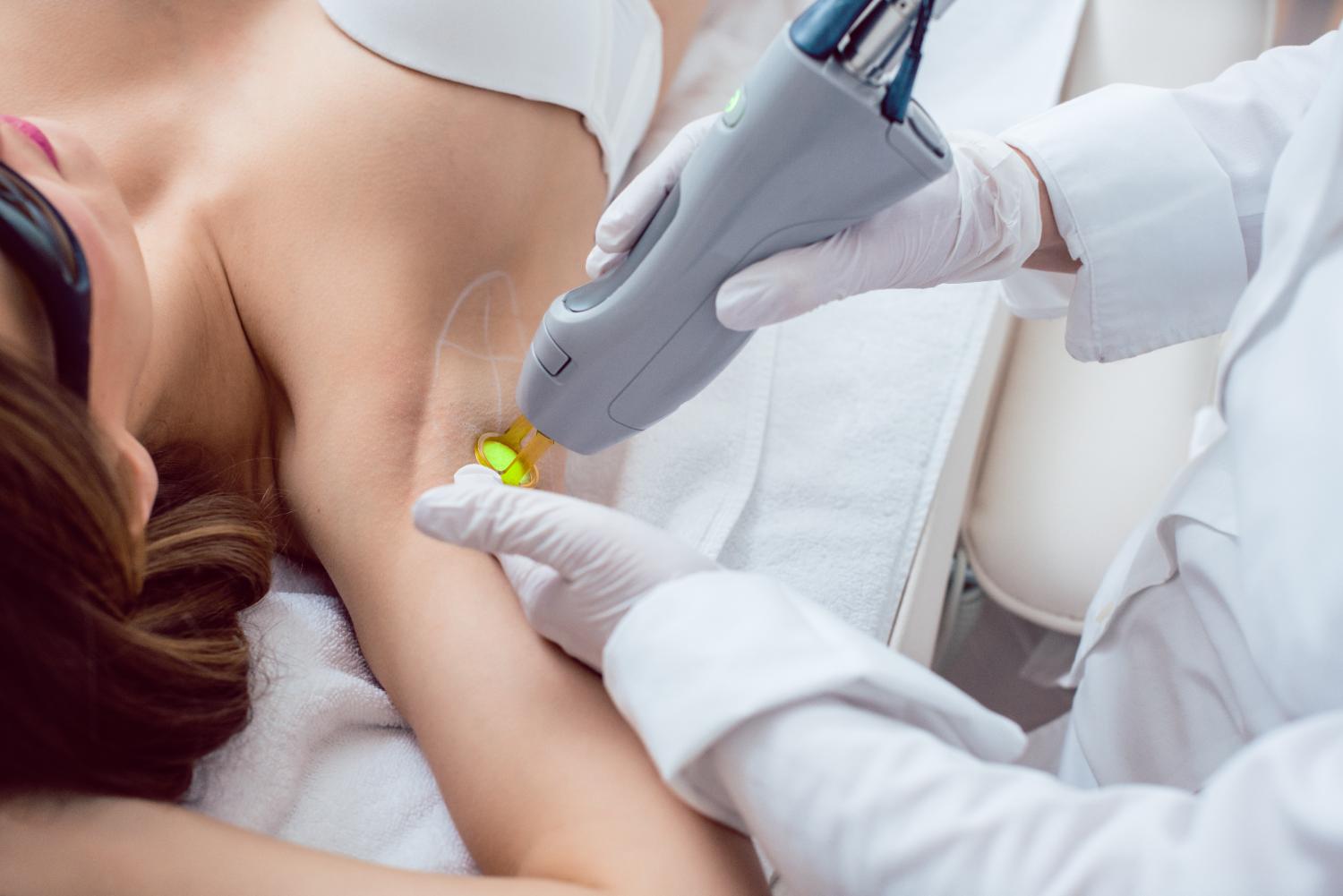 Medical professional using a laser device on a woman’s underarm during a treatment session.